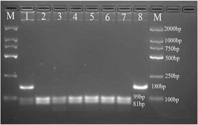 Polymorphism in genes encoding two fatty acid binding proteins increases risk of ischemic stroke in a Chinese Han population